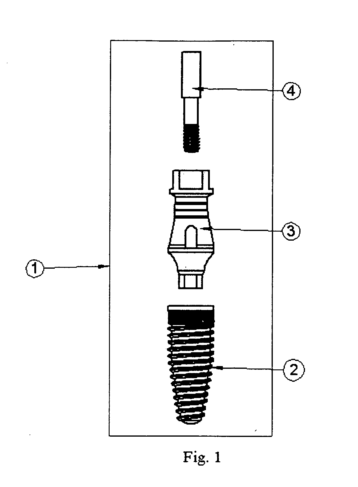 Dental implant system