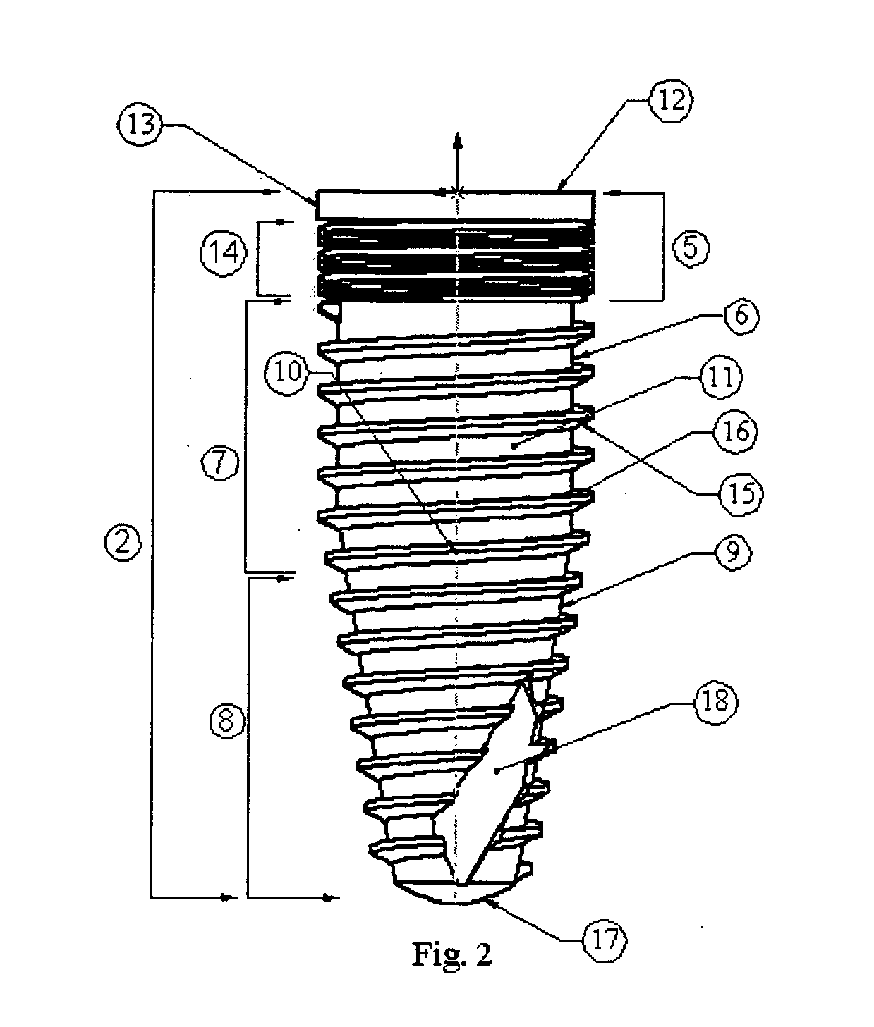 Dental implant system