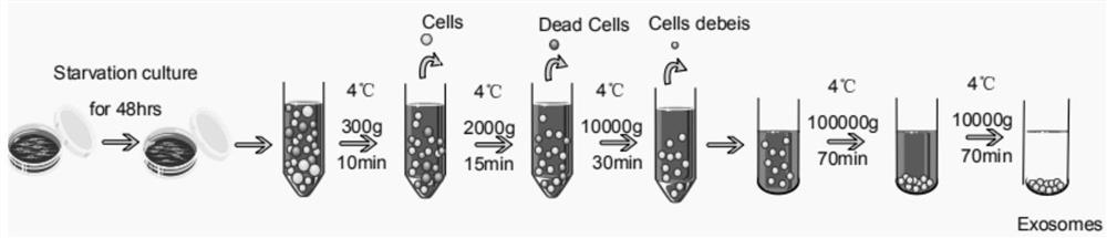 Preparation method and application of norcantharidin-loaded exosome