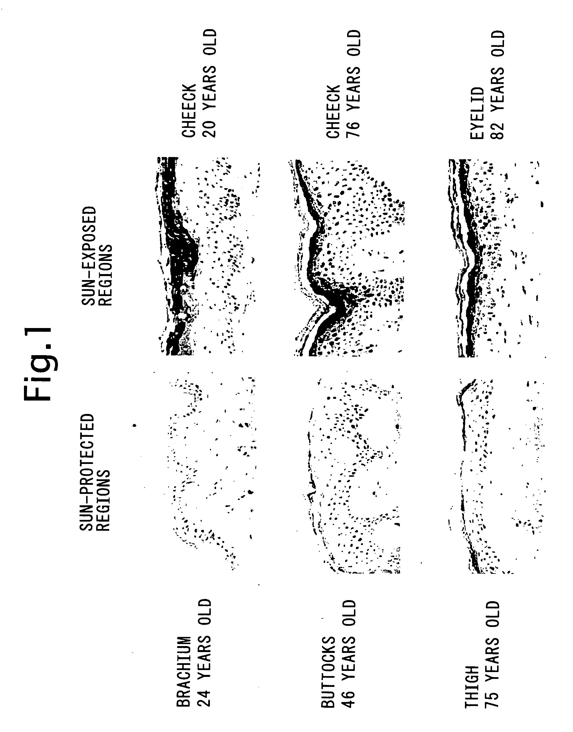 Method for inhibiting jnk-1 kinase activity by SCCA