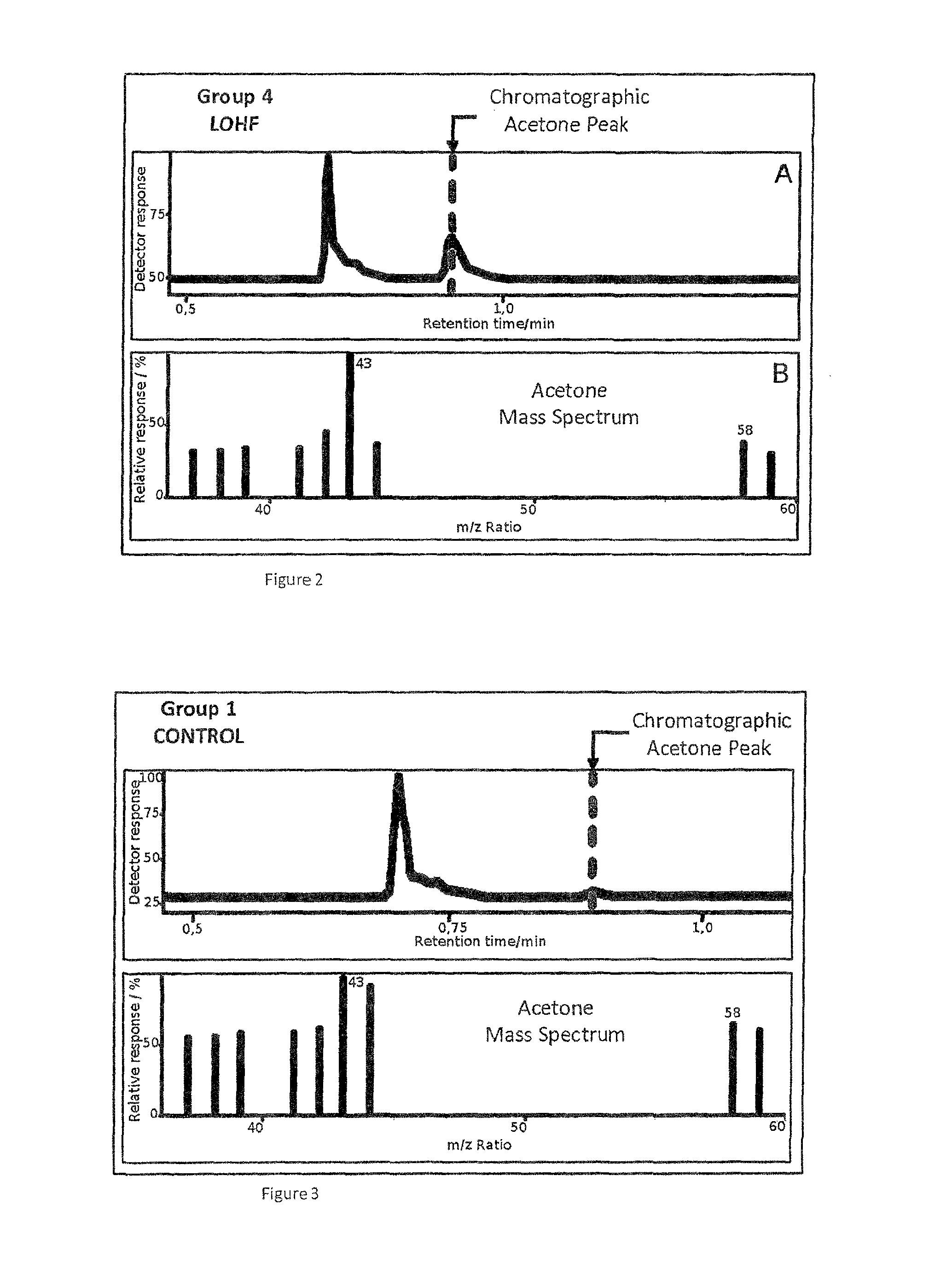 Non-invasive method for diagnosing the severity of heart failure by extracting and analyzing acetone concentrations in captured exhaled breath