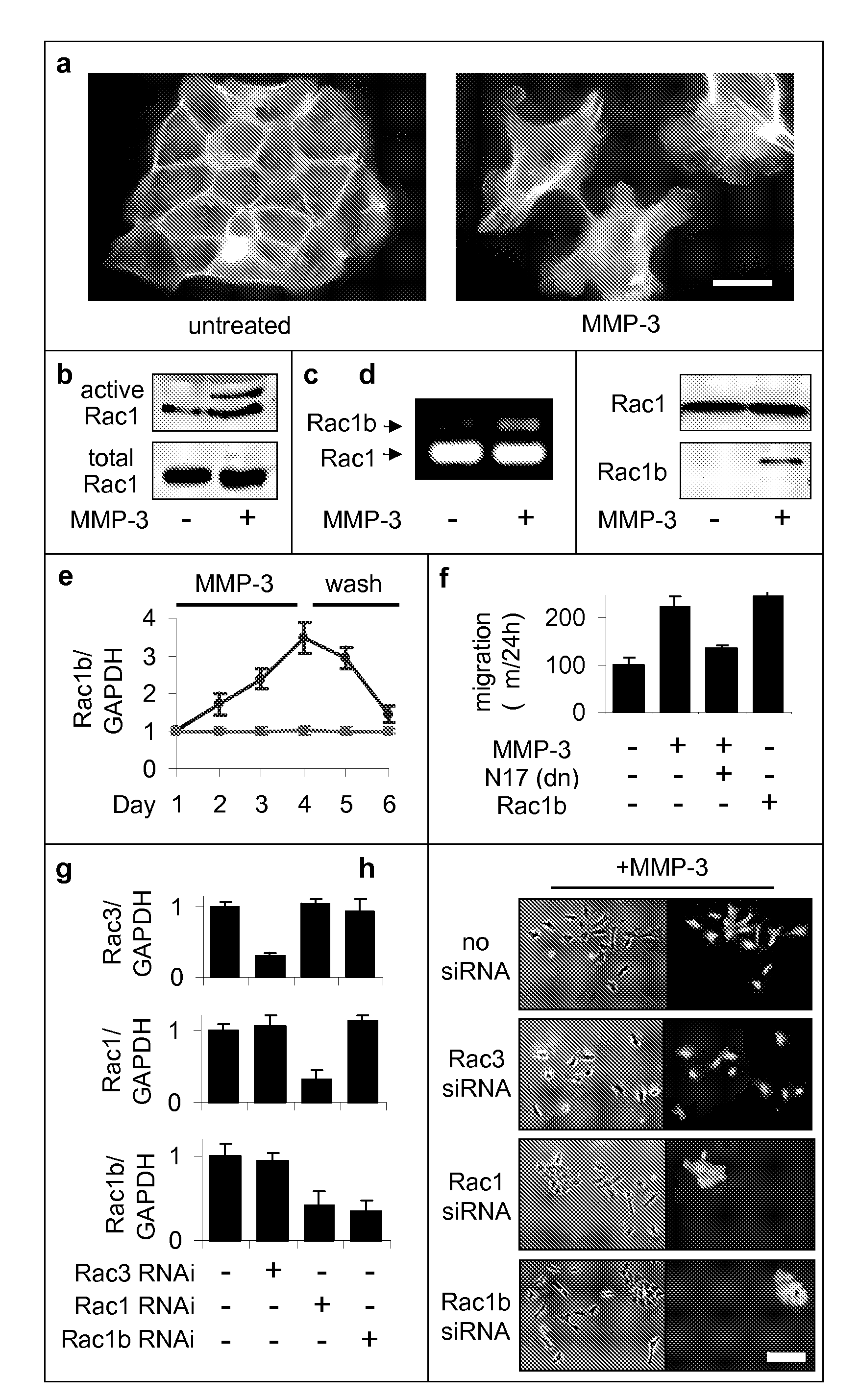 Identification of rac1b as a marker and mediator of metalloproteinase-induced malignancy