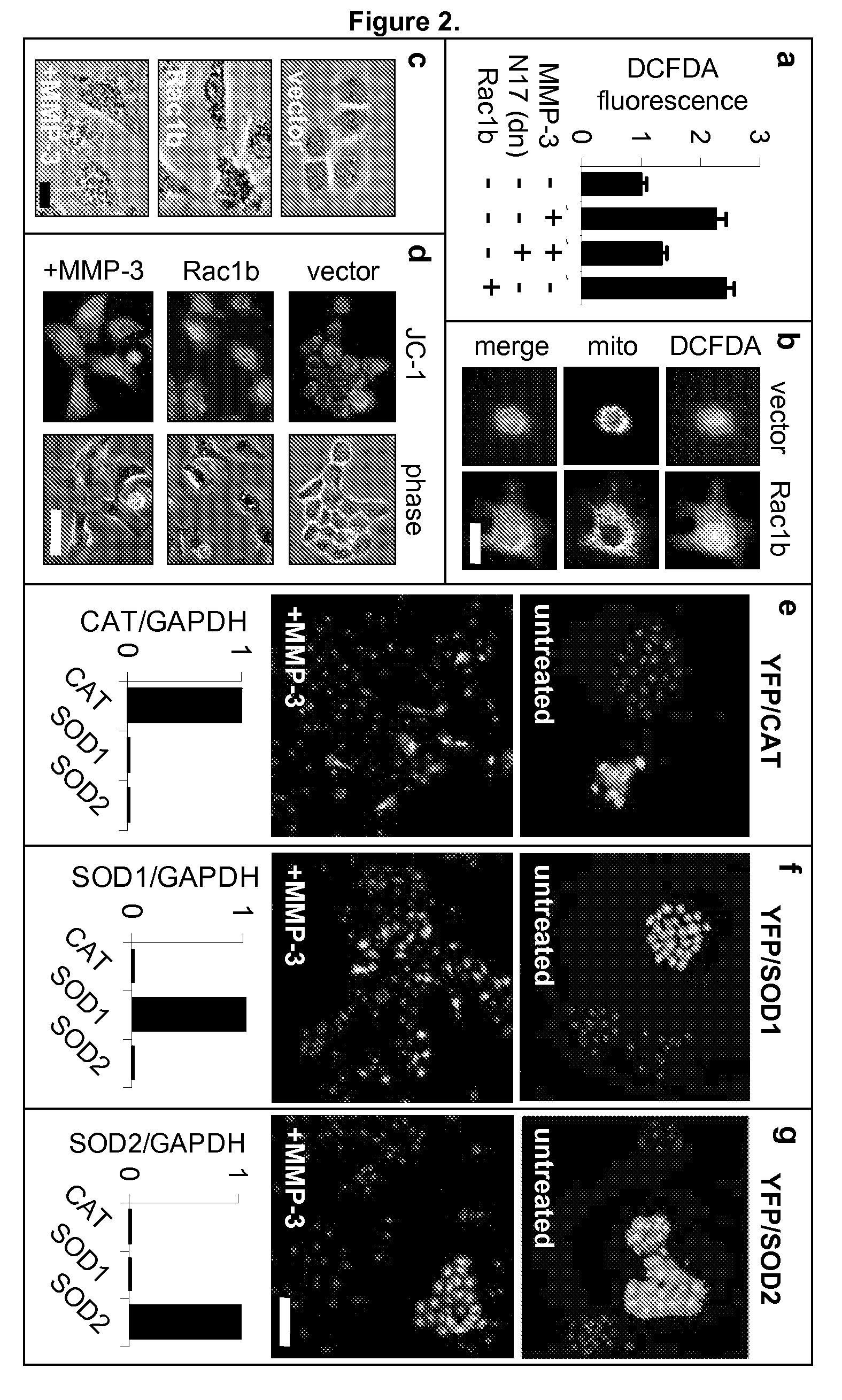 Identification of rac1b as a marker and mediator of metalloproteinase-induced malignancy