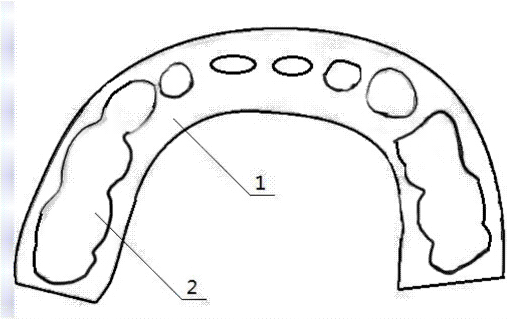 Bonded and fixed bite plate