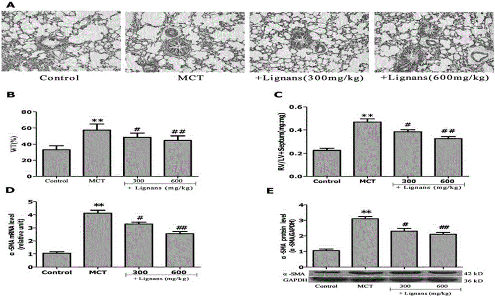 Application of eucommia ulmoides lignan extract in preparation of PH (pulmonary hypertension) treatment drug