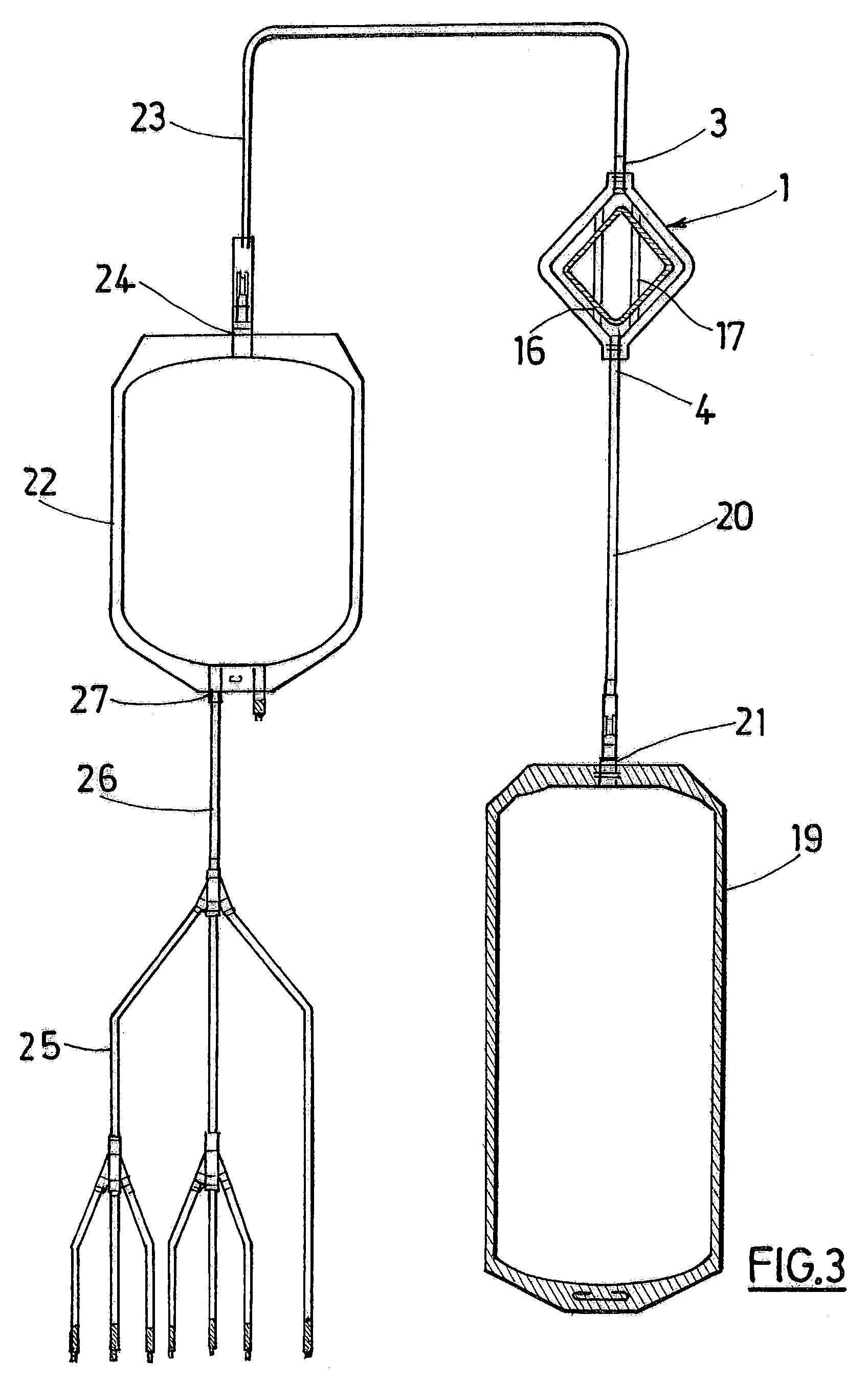 Selective deleukocytation unit for a platelet product