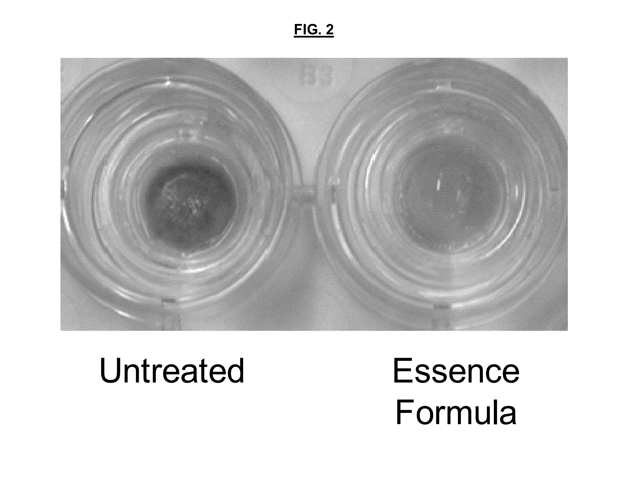 Dickkopf-1 Expression Modulating Compositions and Uses Thereof