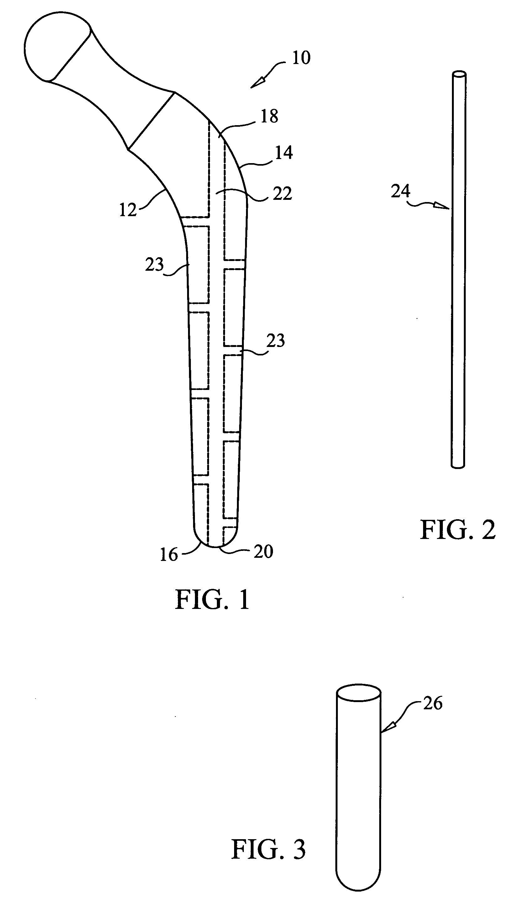 Canulized prosthesis for total hip replacement surgery