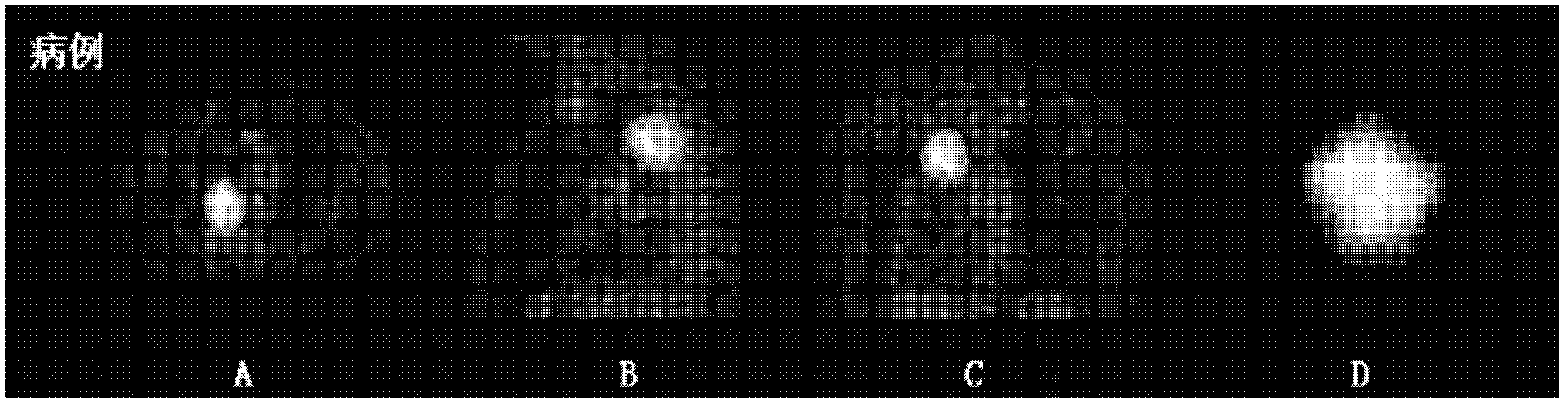 Quantitative assessment method for image heterogeneity characteristics