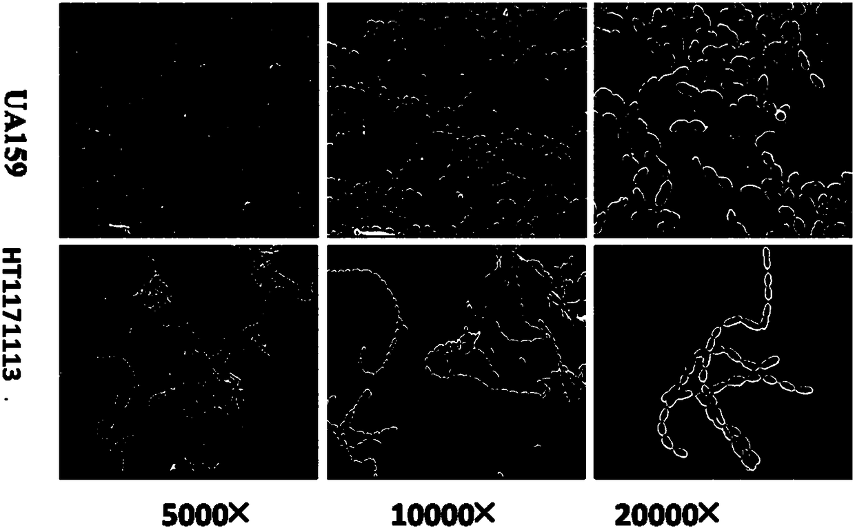 Streptococcus mutans, application of streptococcus mutans and microbial preparation