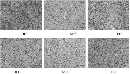 Application of durian peel polysaccharide in preparation of immune-enhancing drug