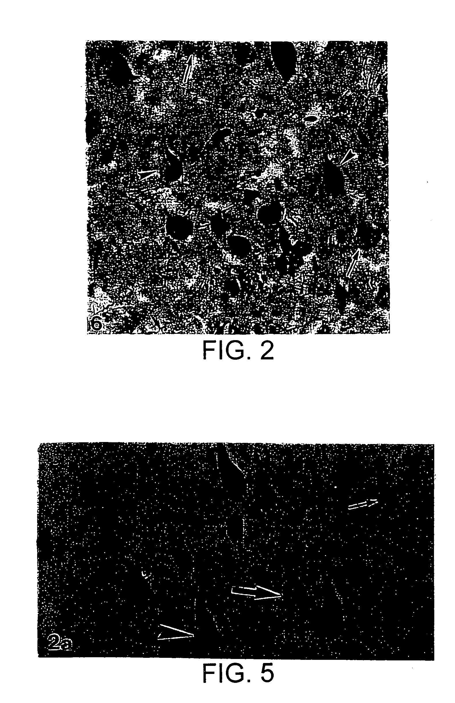 Molecular markers for the diagnosis of Alzheimer's disease