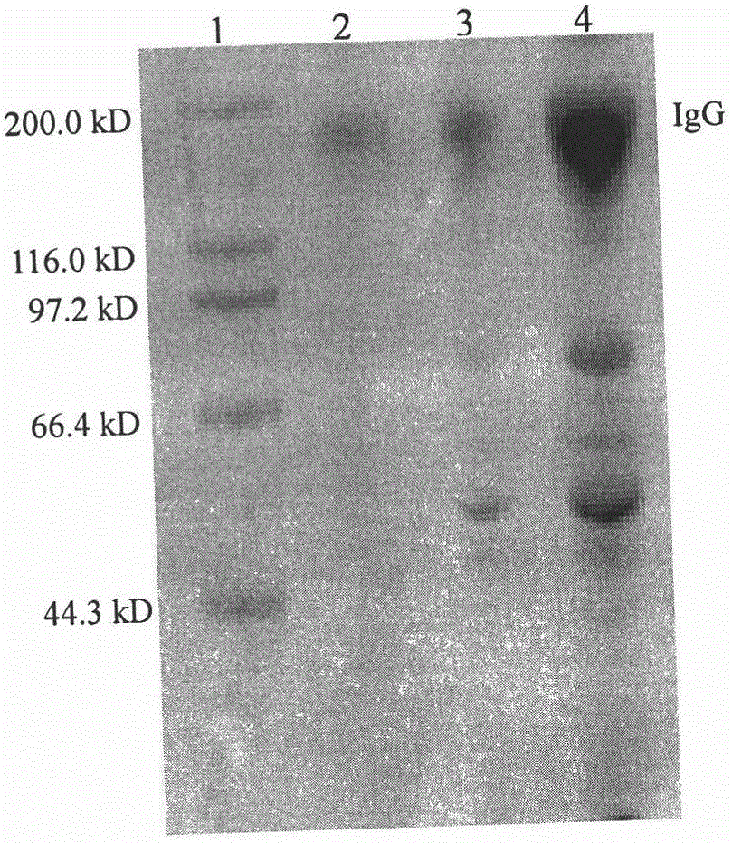 A performance-improved recombinant Staphylococcus aureus protein a affinity ligand and its construction method