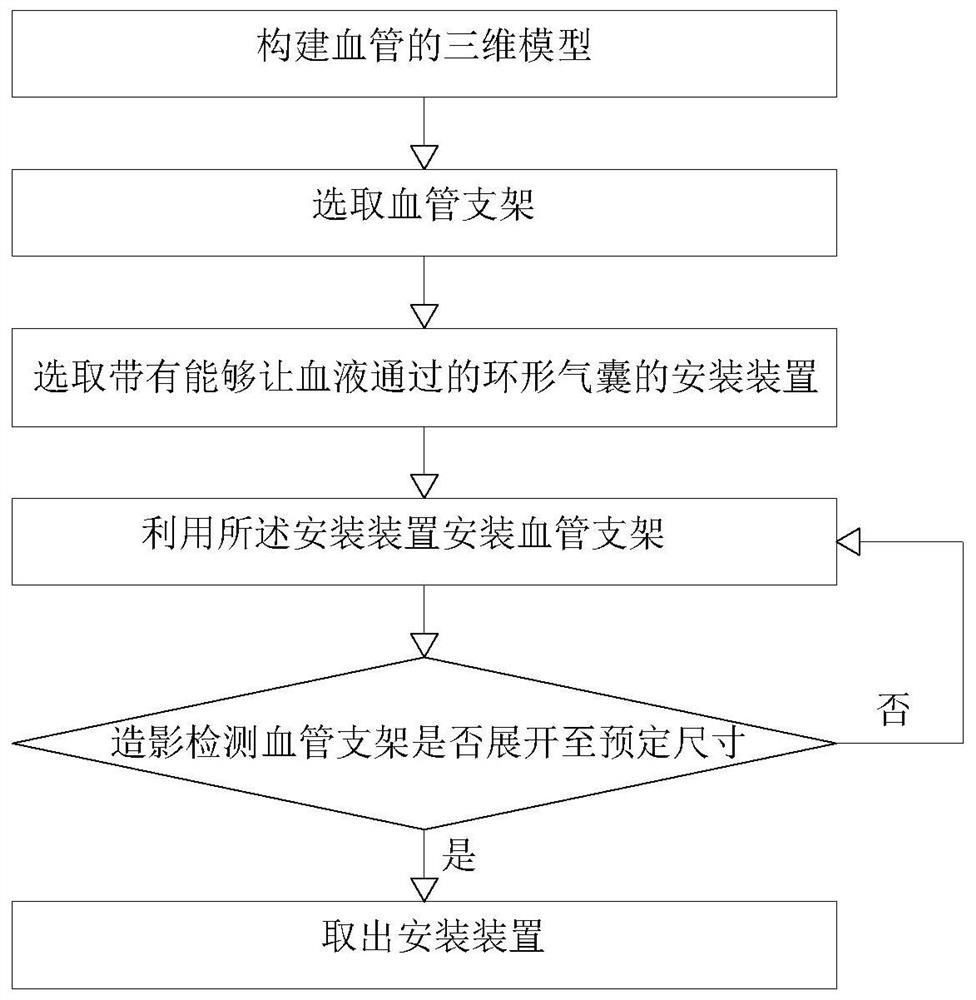 A kind of vascular stent installation device