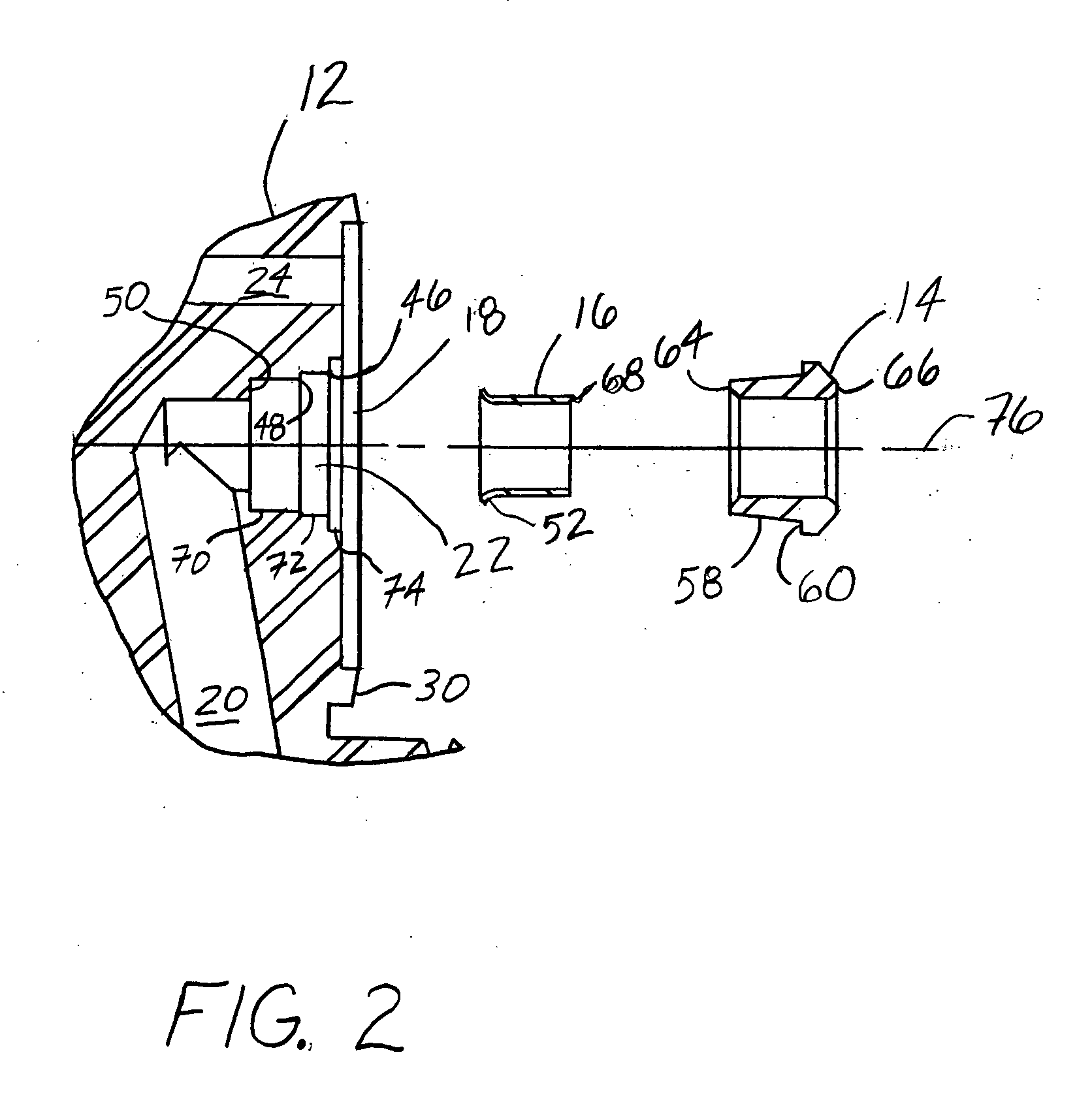 Removable valve seat member for diaphragm valve