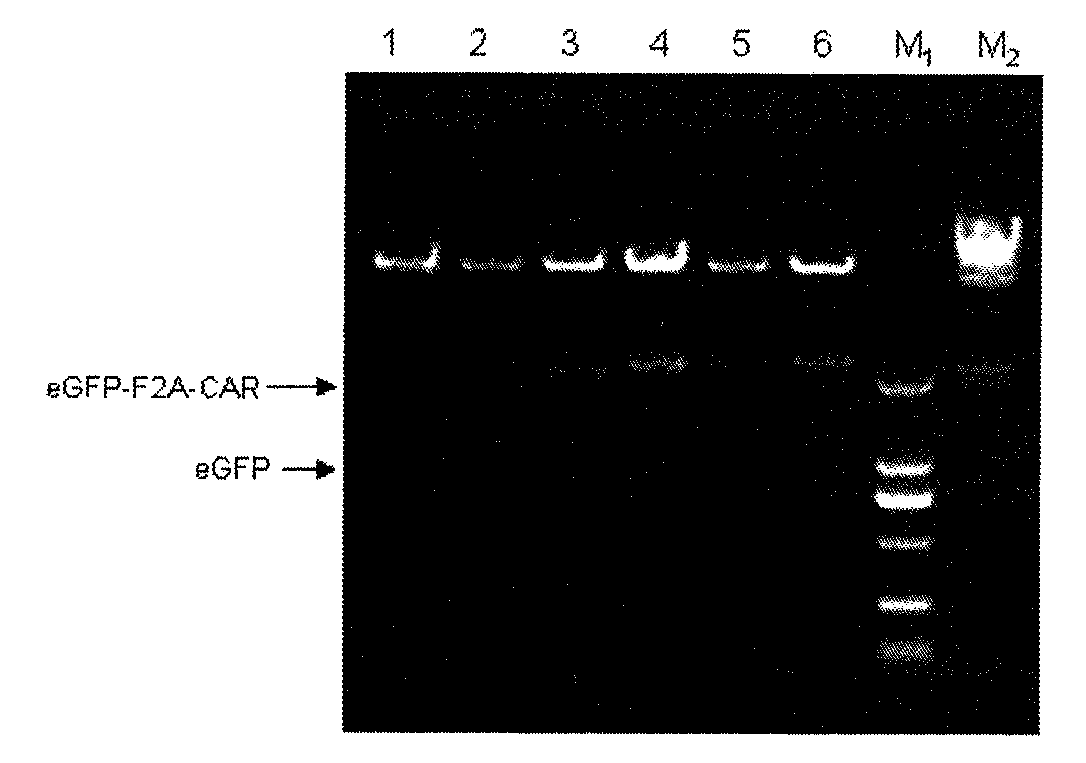 Nucleic acid for coding chimeric antigen receptor protein and T lymphocyte for expression of chimeric antigen receptor protein