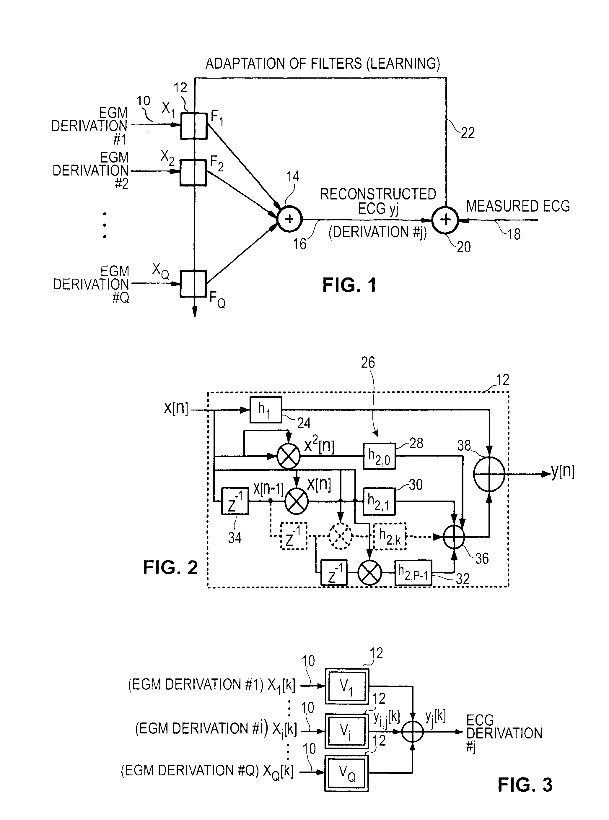 Non-linear filtering for the reconstruction of a surface Electrocardiogram from an endocardial electrogram