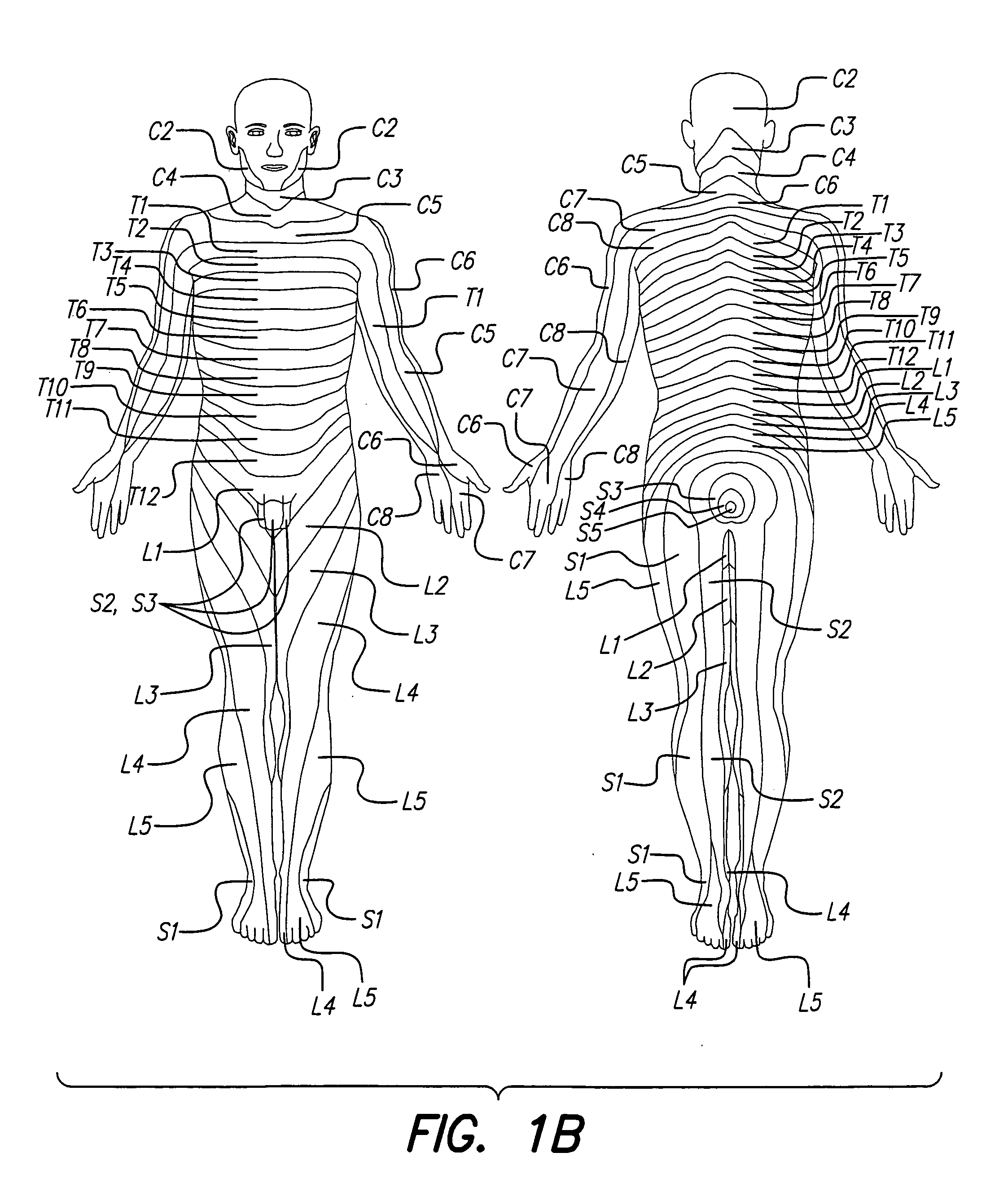 Methods for implanting a spinal cord stimulator