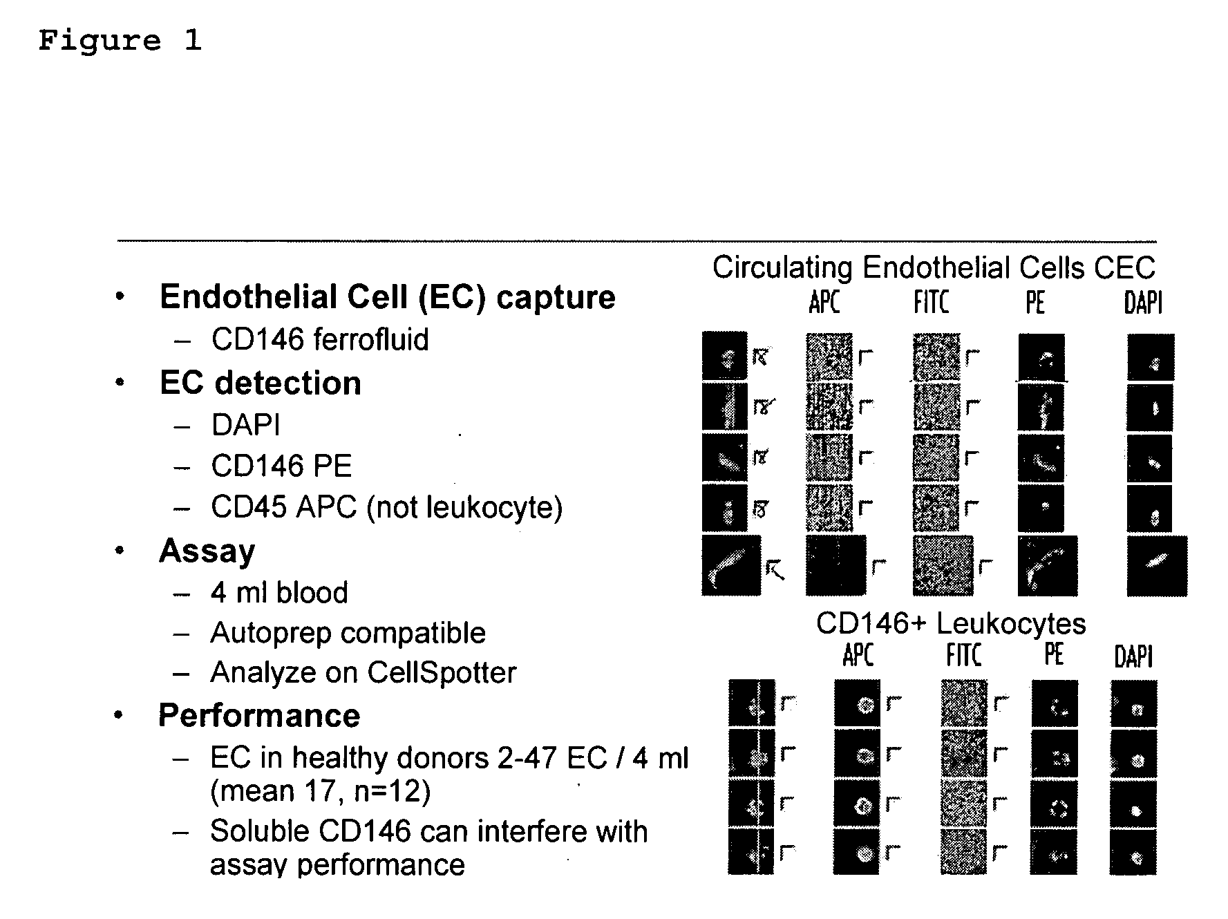 Method for assessing disease states by profile analysis of isolated circulating endothelial cells