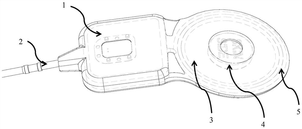 Artificial cochlea implant