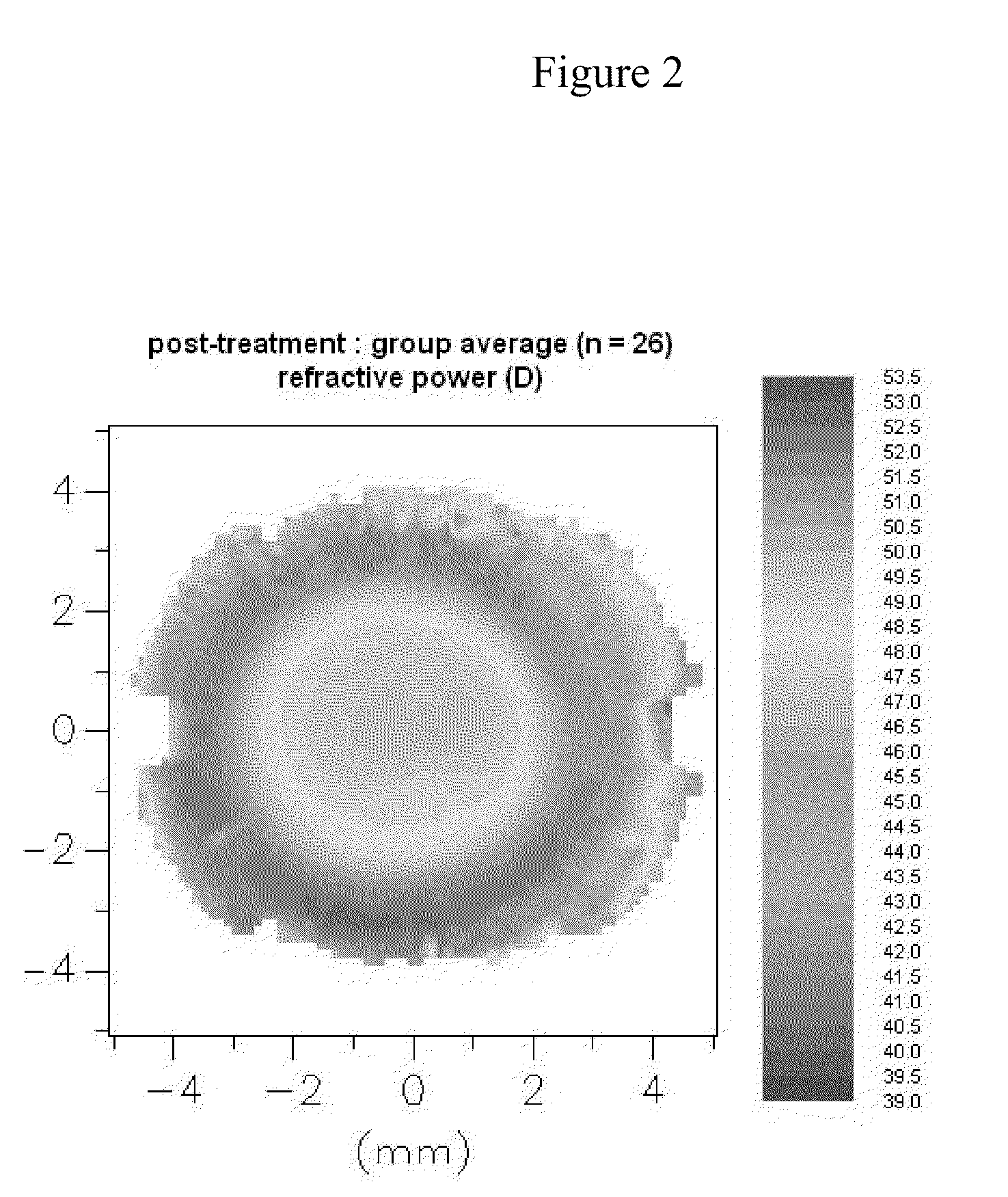 Myopia control ophthalmic lenses