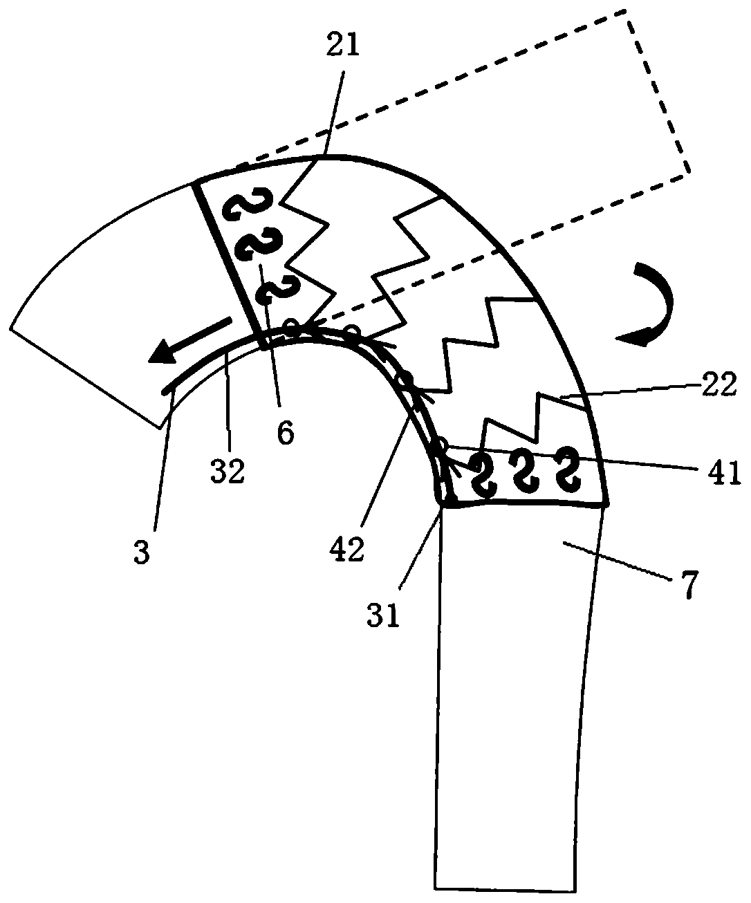 A covered stent