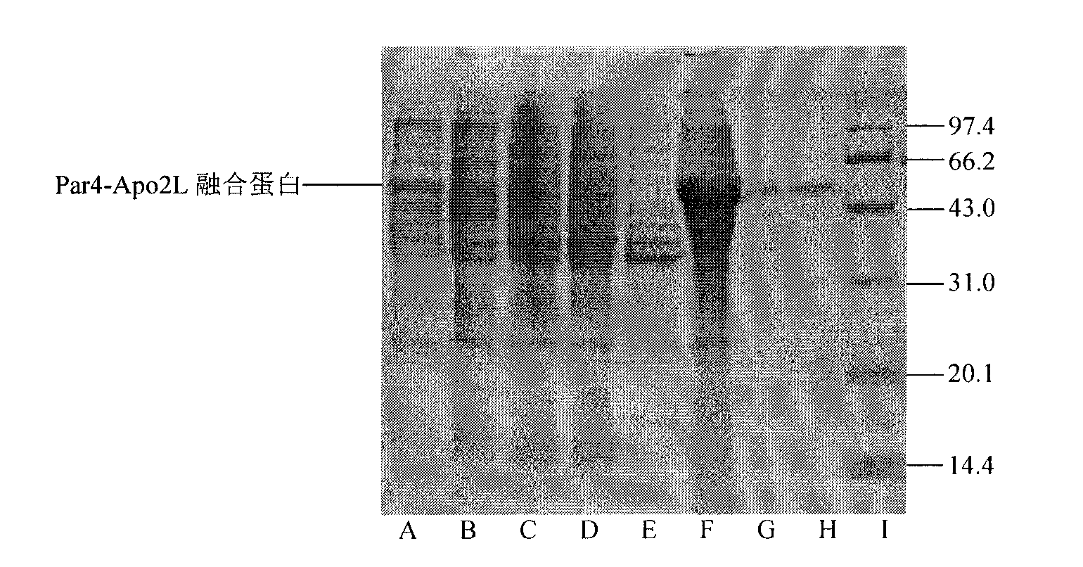 Preparation method and application of human prostate apoptosis response protein 4 and apoptin 2 ligand fusion protein