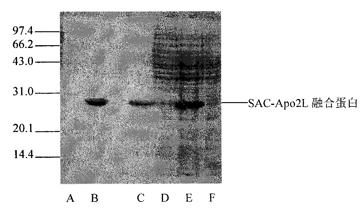 Preparation method and application of human prostate apoptosis response protein 4 and apoptin 2 ligand fusion protein