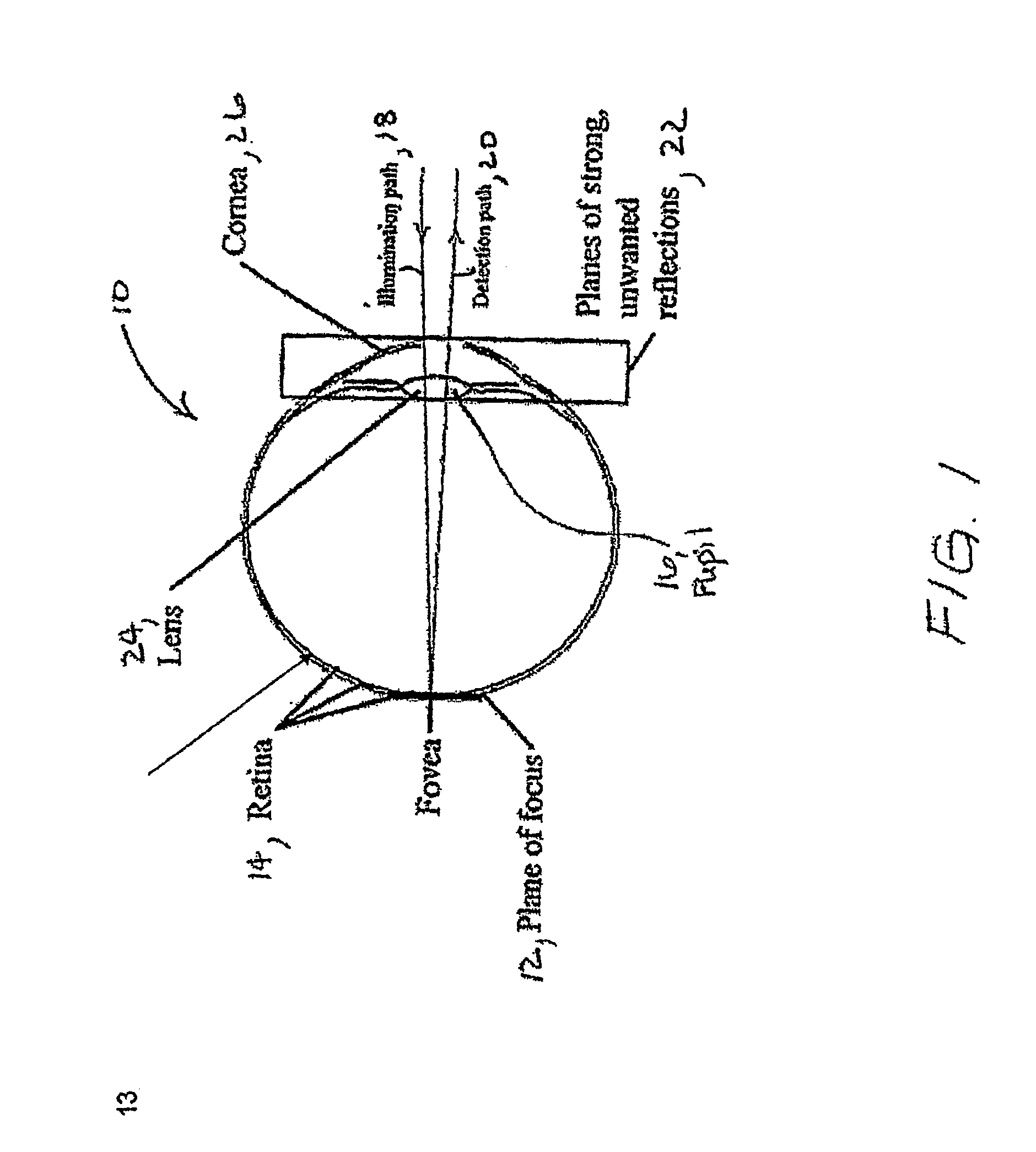 Laser scanning digital camera with simplified optics and potential for multiply scattered light imaging