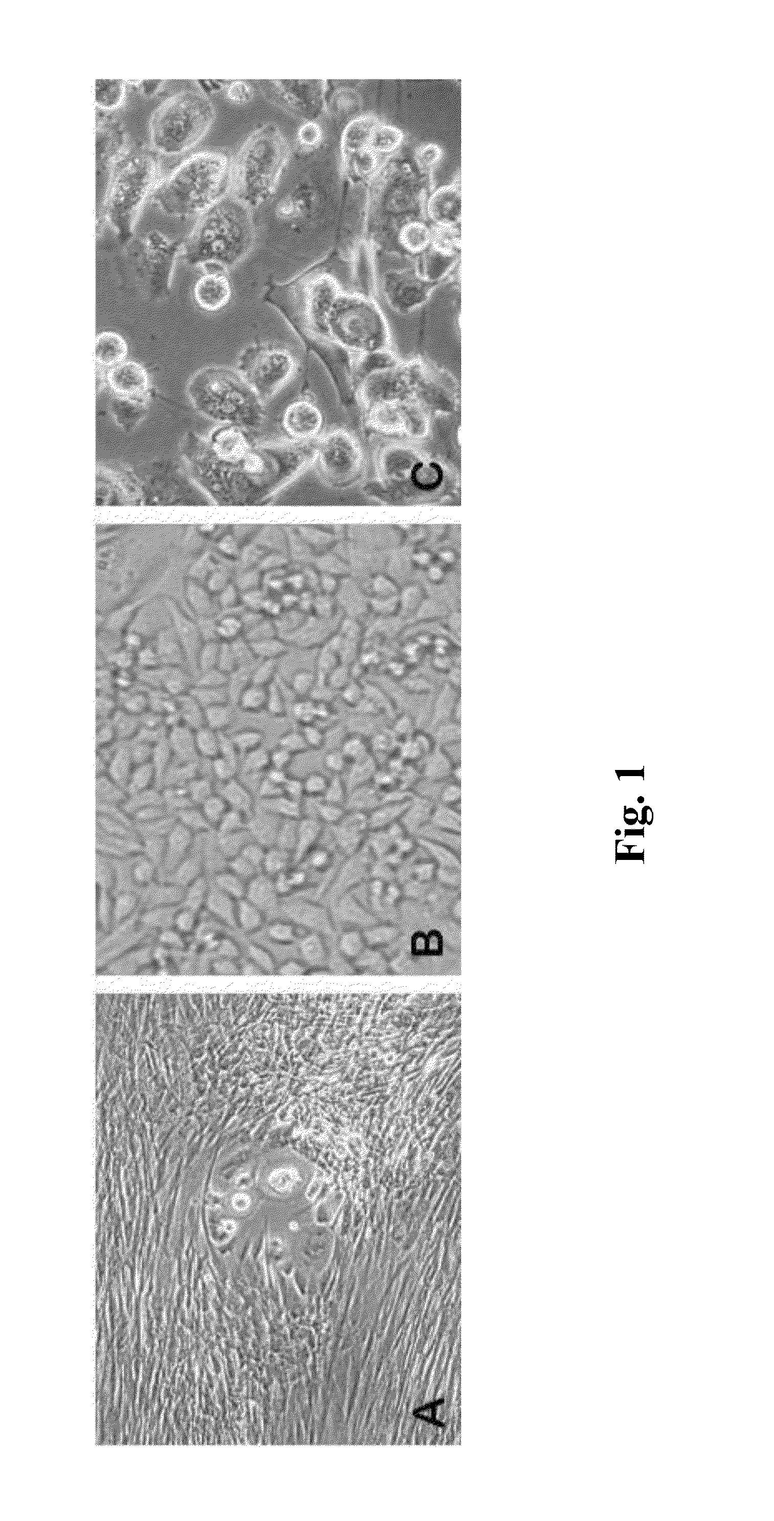 Spontaneously immortalized prostate cancer cell line