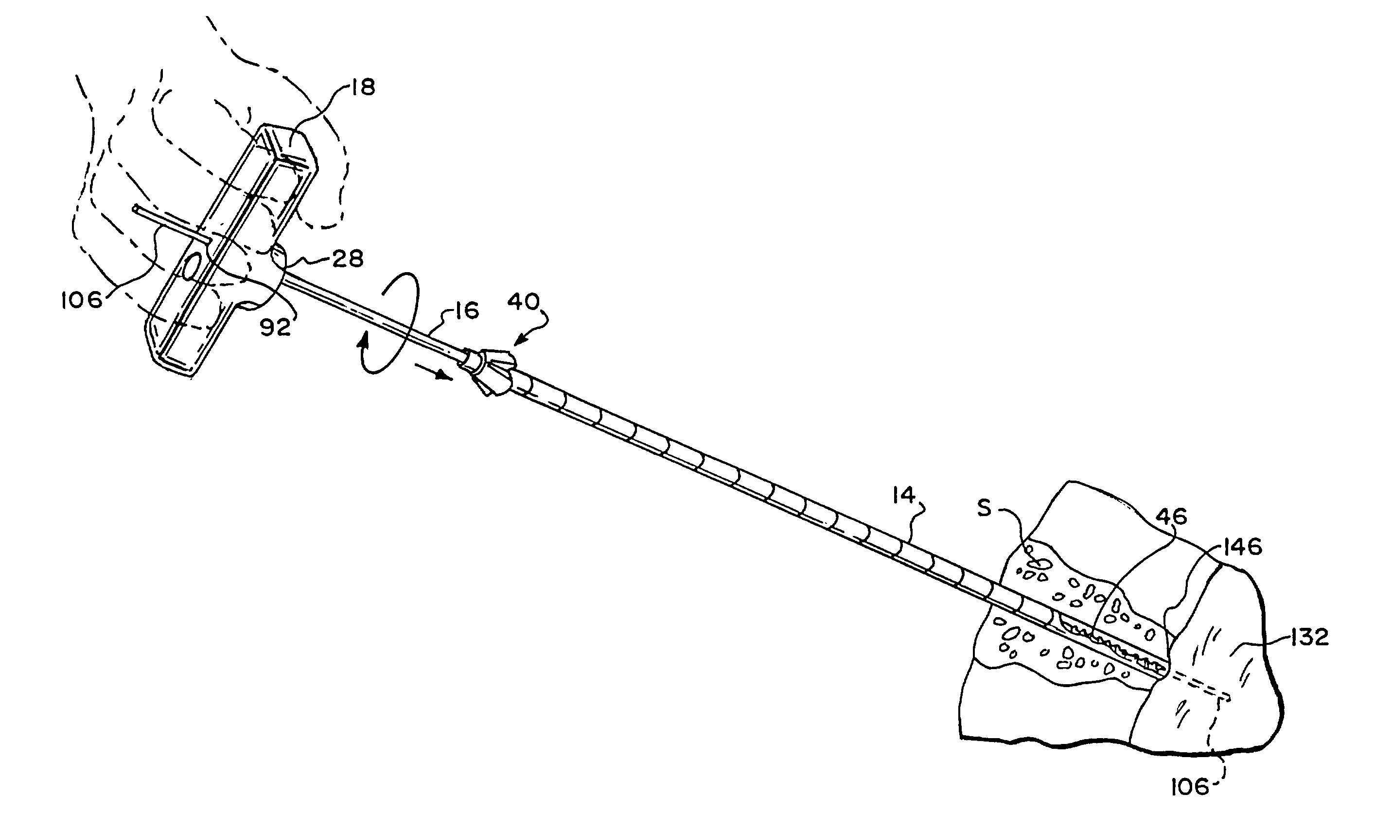 Slip-fit handle for hand-held instruments that access interior body regions