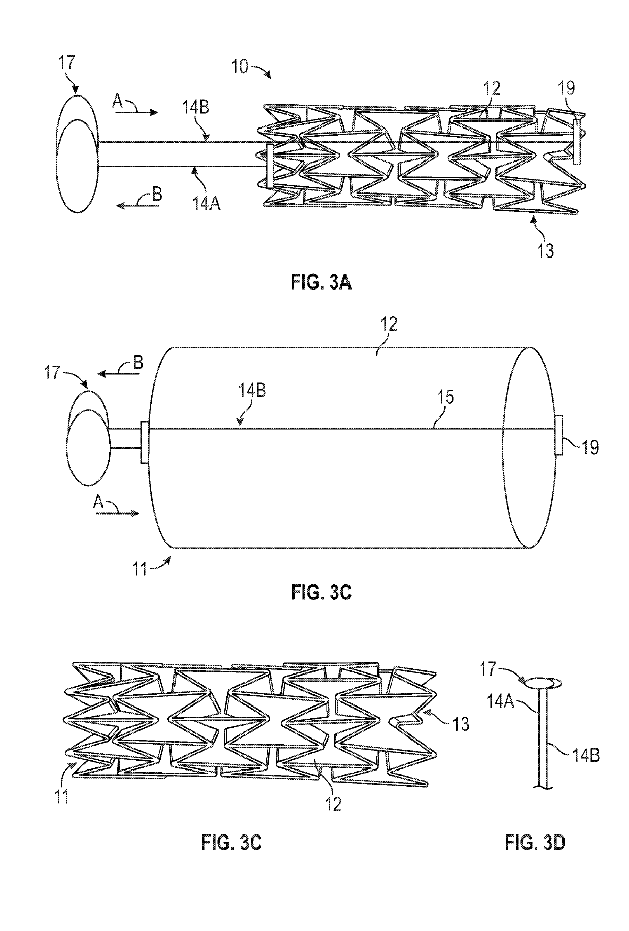 Aortic Arch Embolic Protection Device