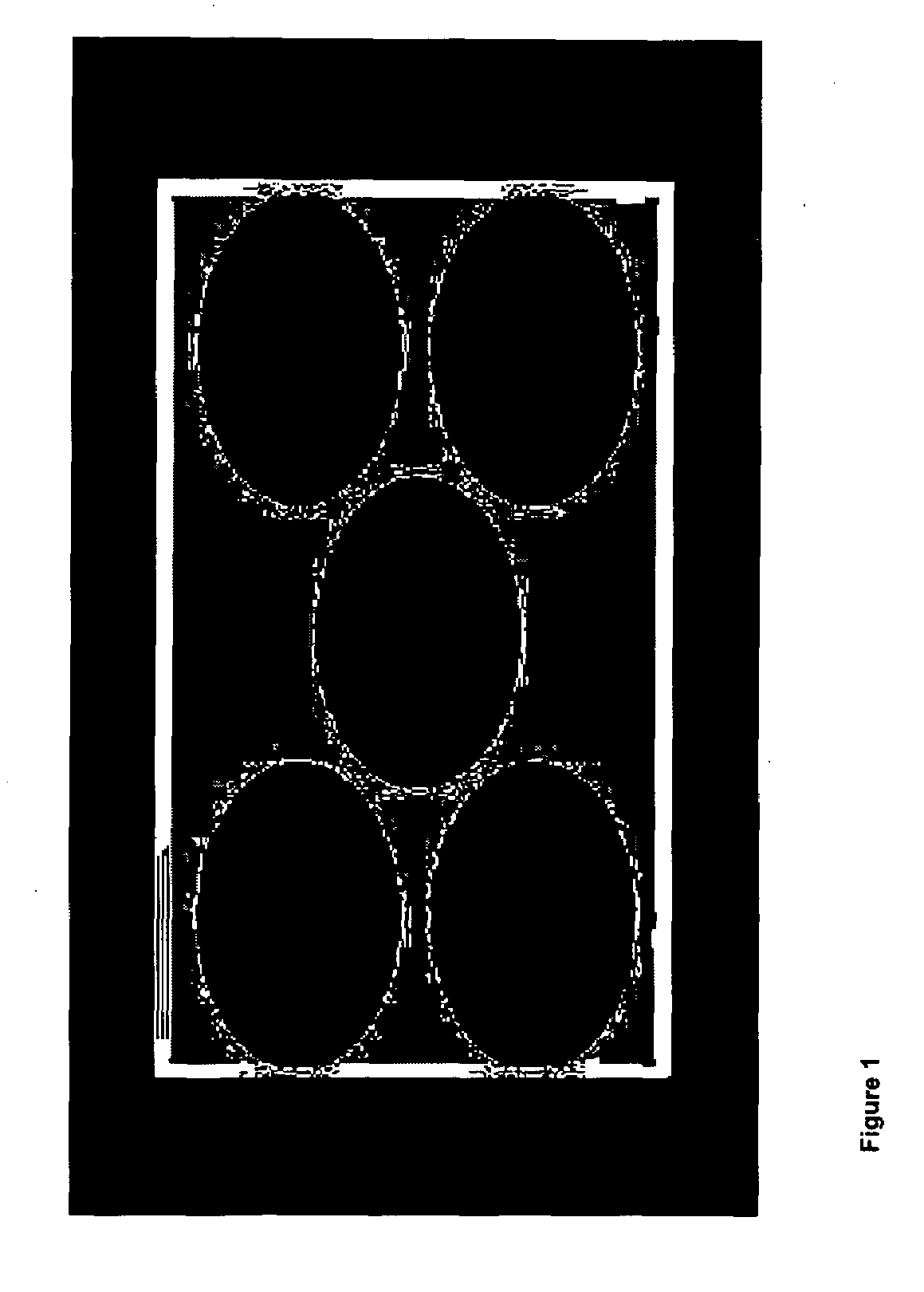 Method and apparatus for managing non-used areas of a digital video display when video of other aspect ratios are being displayed