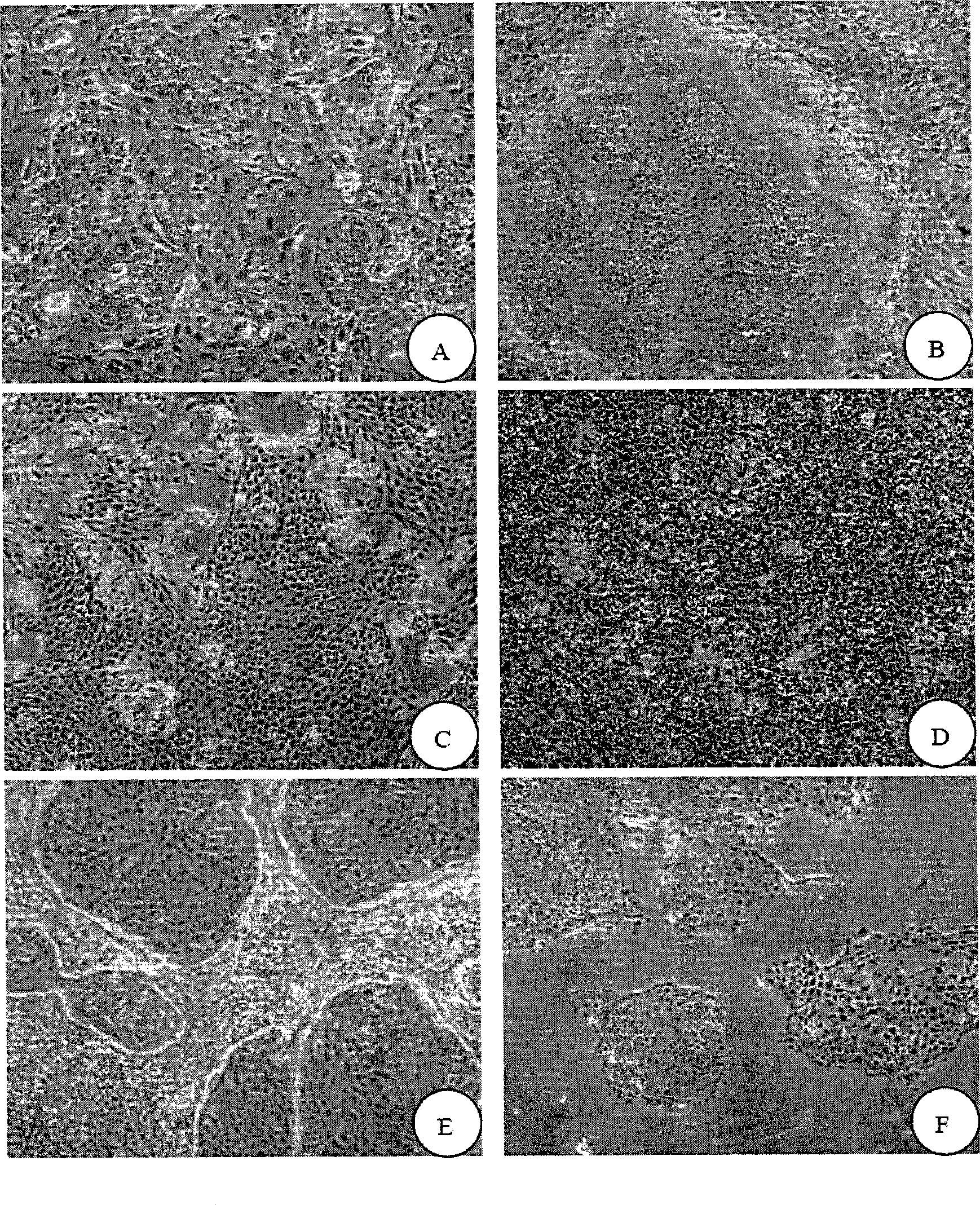 Method for preparing mucosal graft