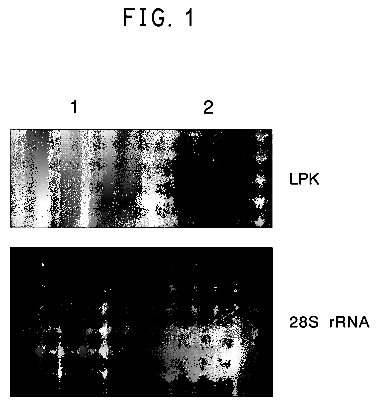 Insulin-secreting immortalized liver cell line modified by glucose sensitivity