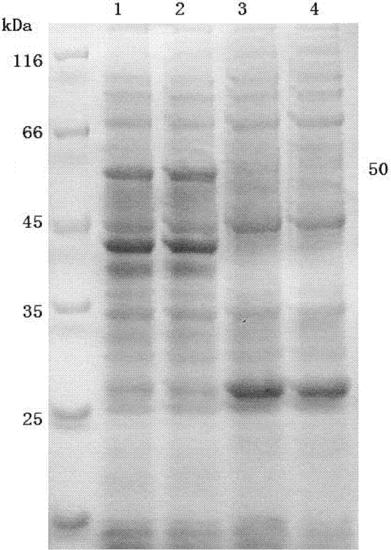 Diaminobutyrate-2-oxoglutarate transaminase and application thereof