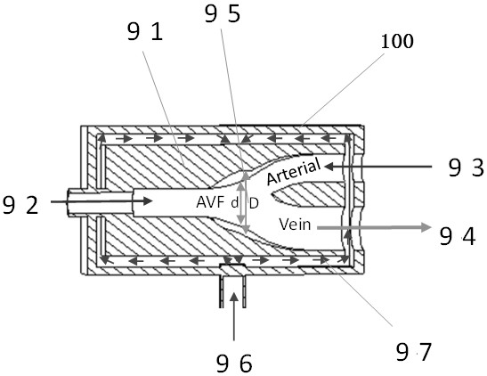 A physical simulation model device of hemodynamics in vitro of arteriovenous fistula