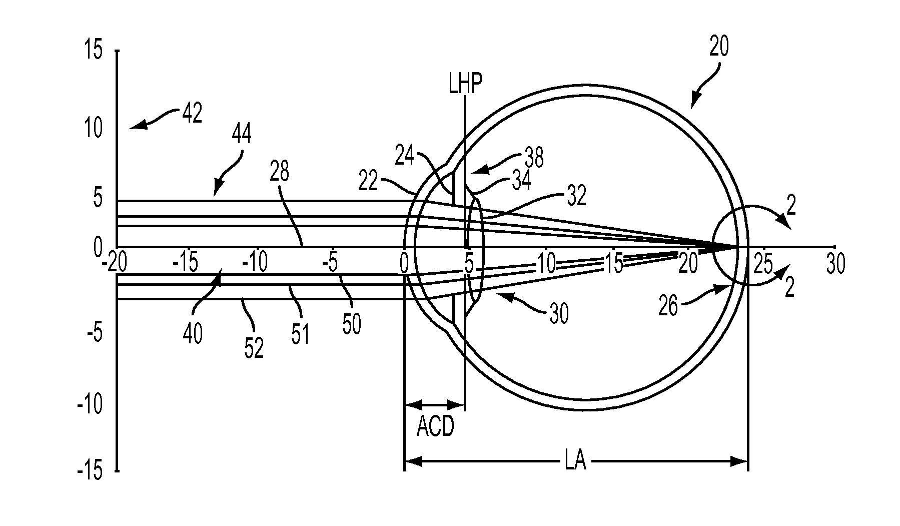 Apparatus, system and method to account for spherical aberration at the iris plane in the design of an intraocular lens