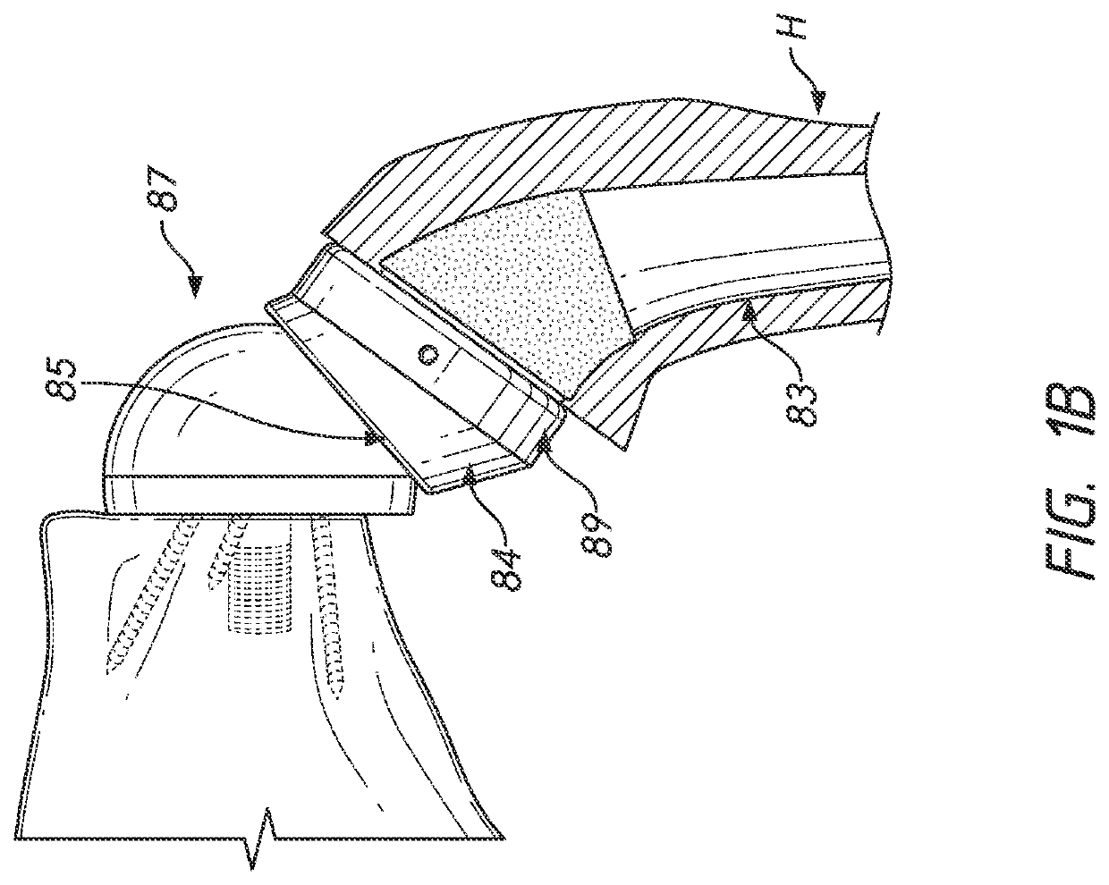 Shoulder prosthesis components and assemblies