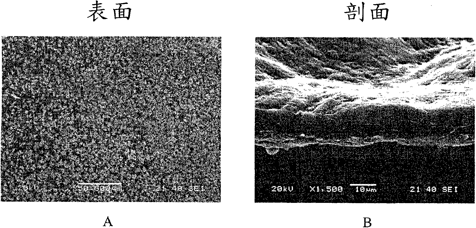 Method for preparing a cell-derived extracellular matrix membrane