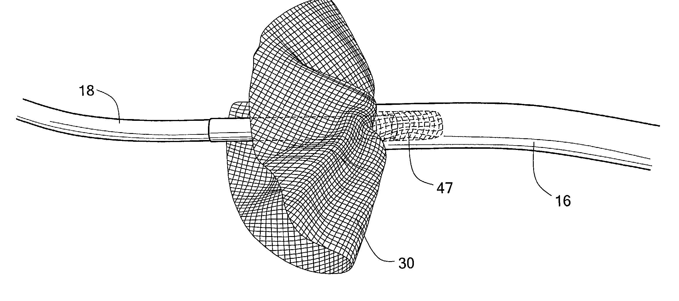 Containerless tissue sample collection trap