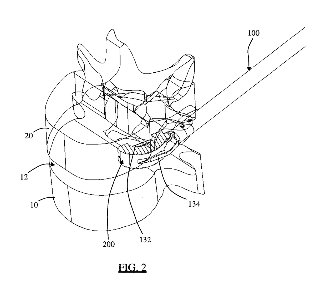 System and methods for performing transforaminal lumbar interbody fusion