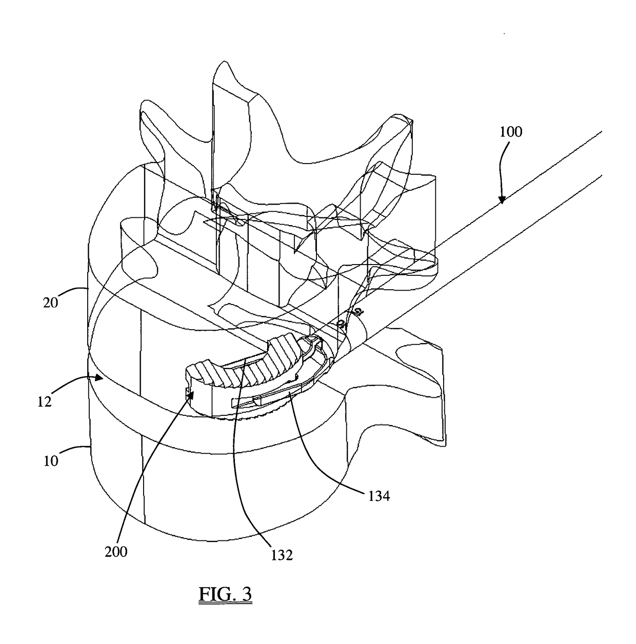 System and methods for performing transforaminal lumbar interbody fusion