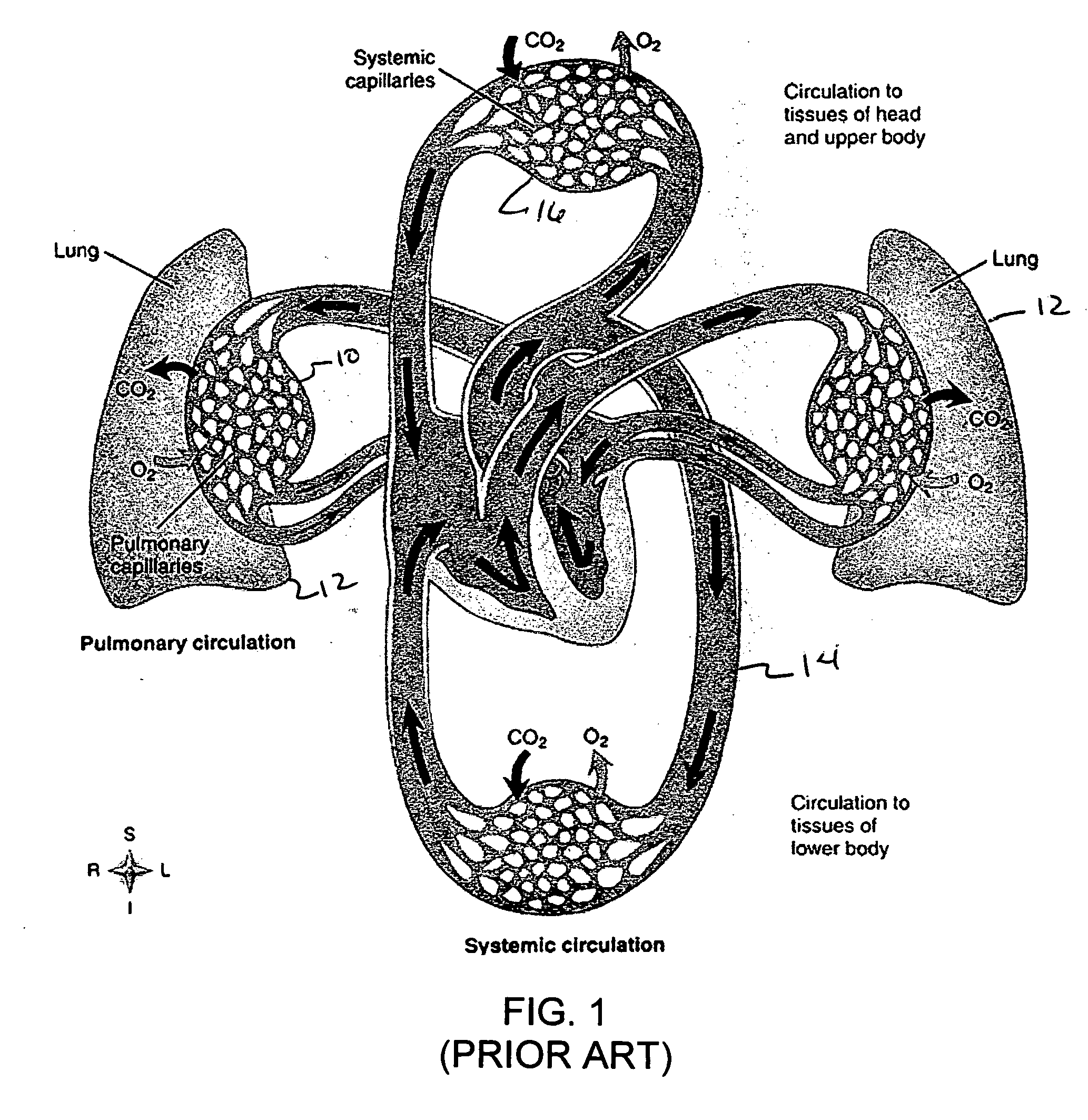 Dive computer and method for determining gas formation