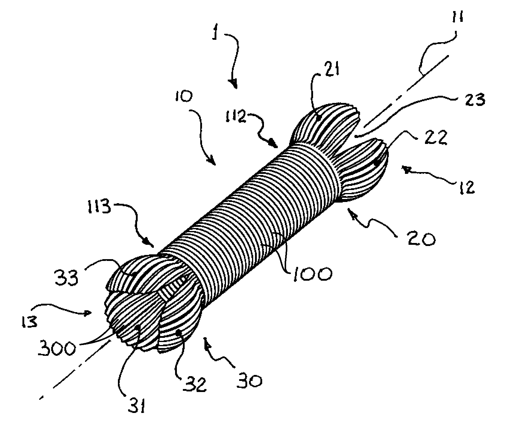 Aortic conduit configured with terminal ends having neosinuses of valsalva