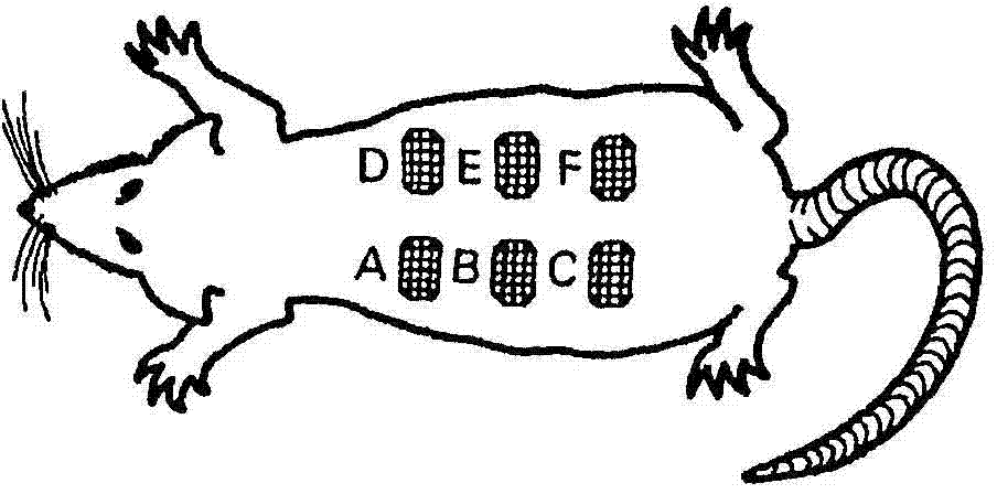 Pharmaceutical composition of microspheres for preventing diabetic foot amputation