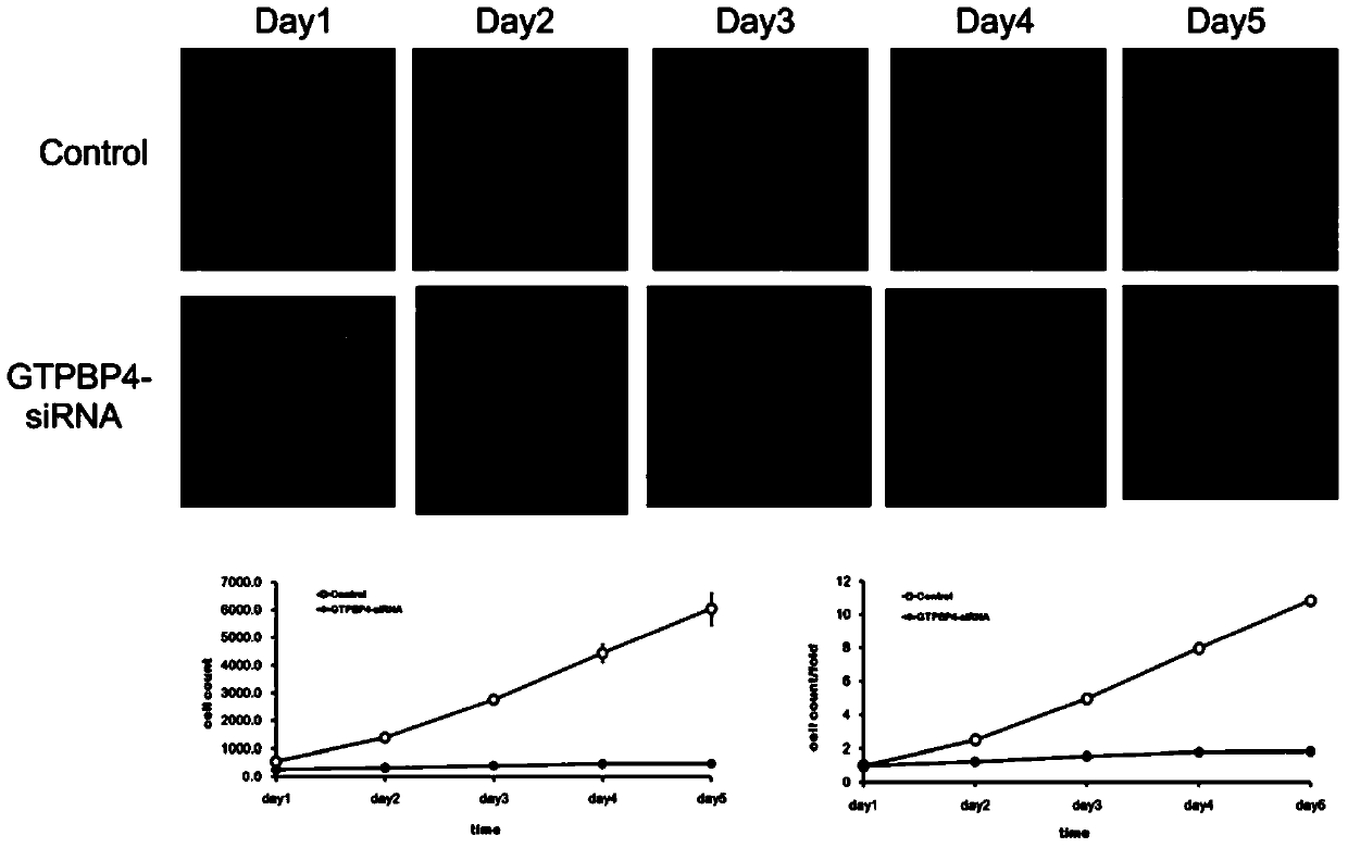 Use of human gtpbp4 gene and related medicines