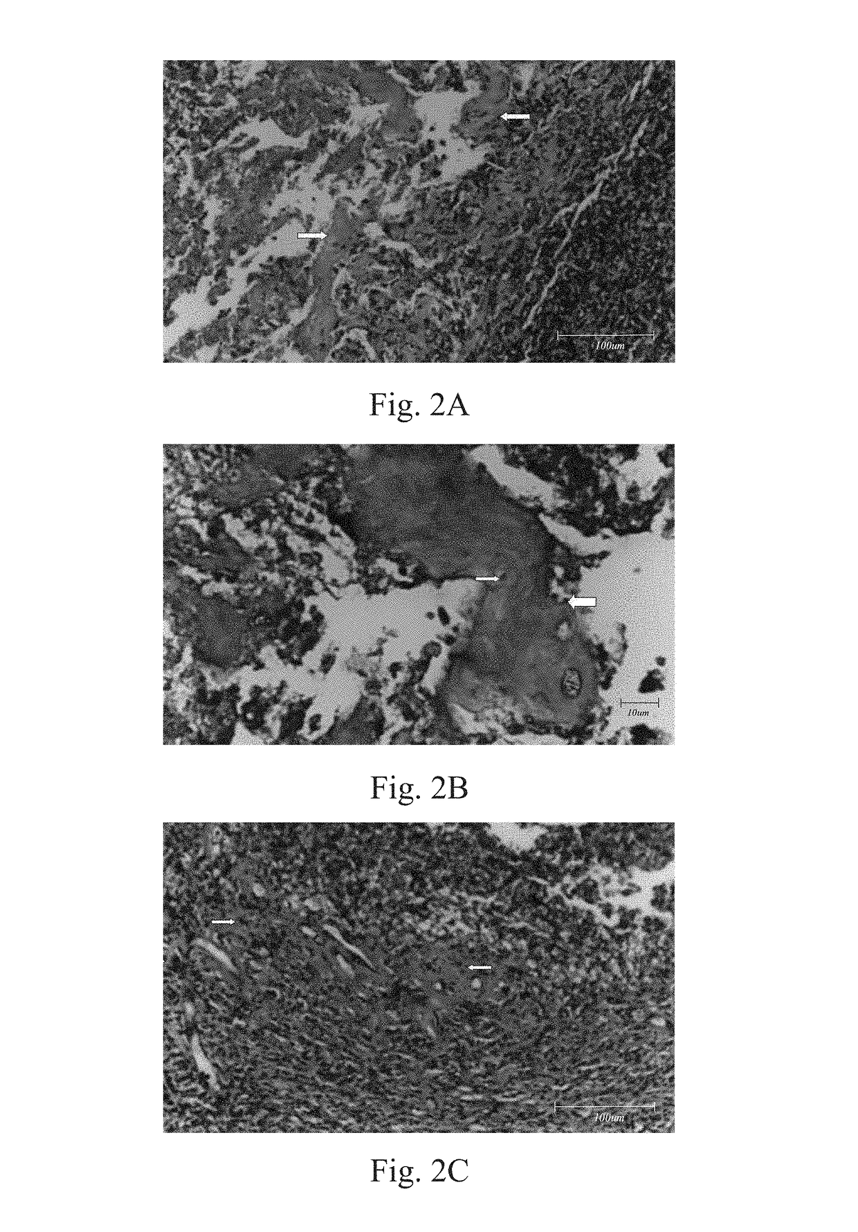 Method of inducing osteogensis and promoting osseointegration around an implant