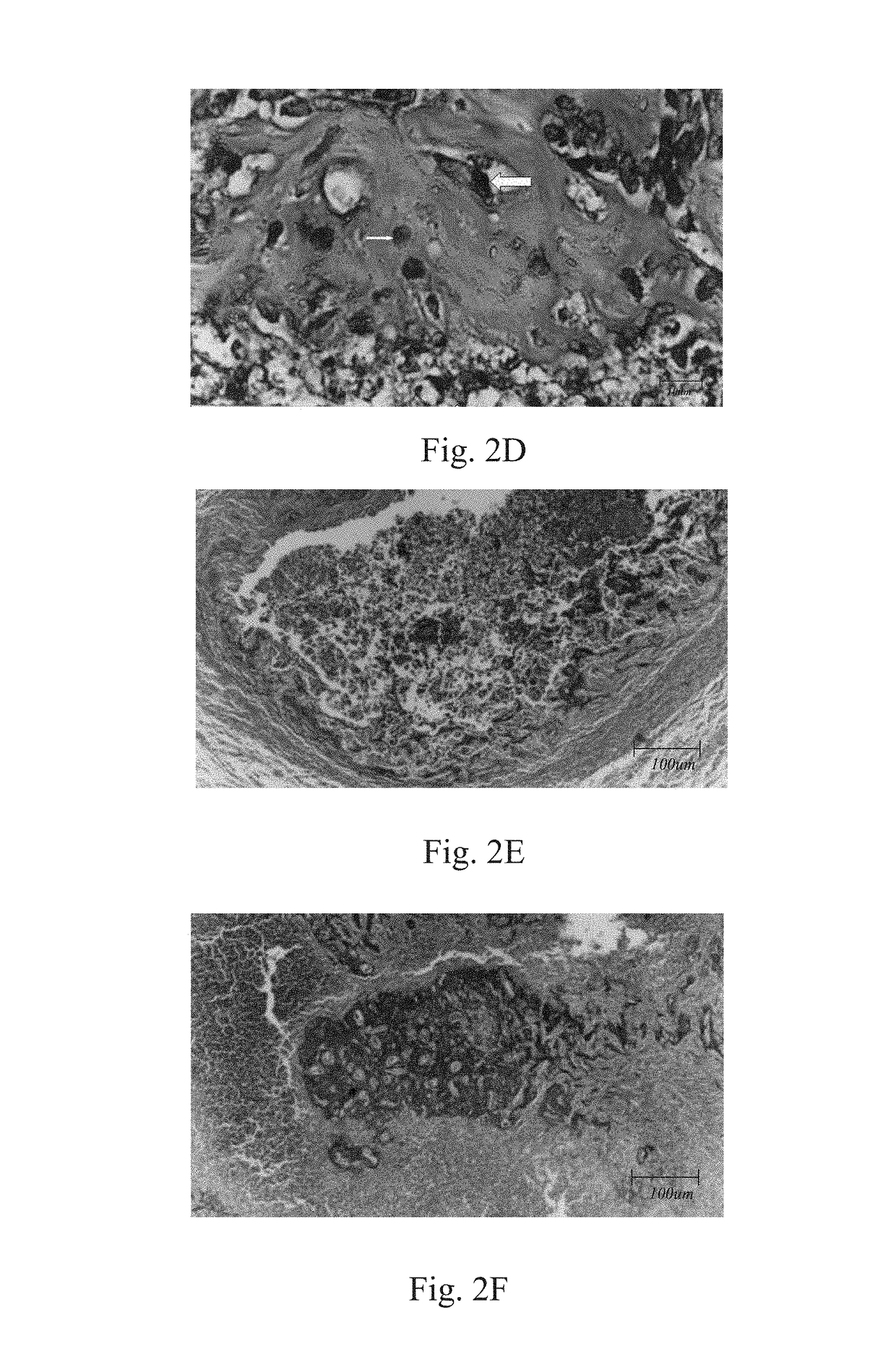 Method of inducing osteogensis and promoting osseointegration around an implant