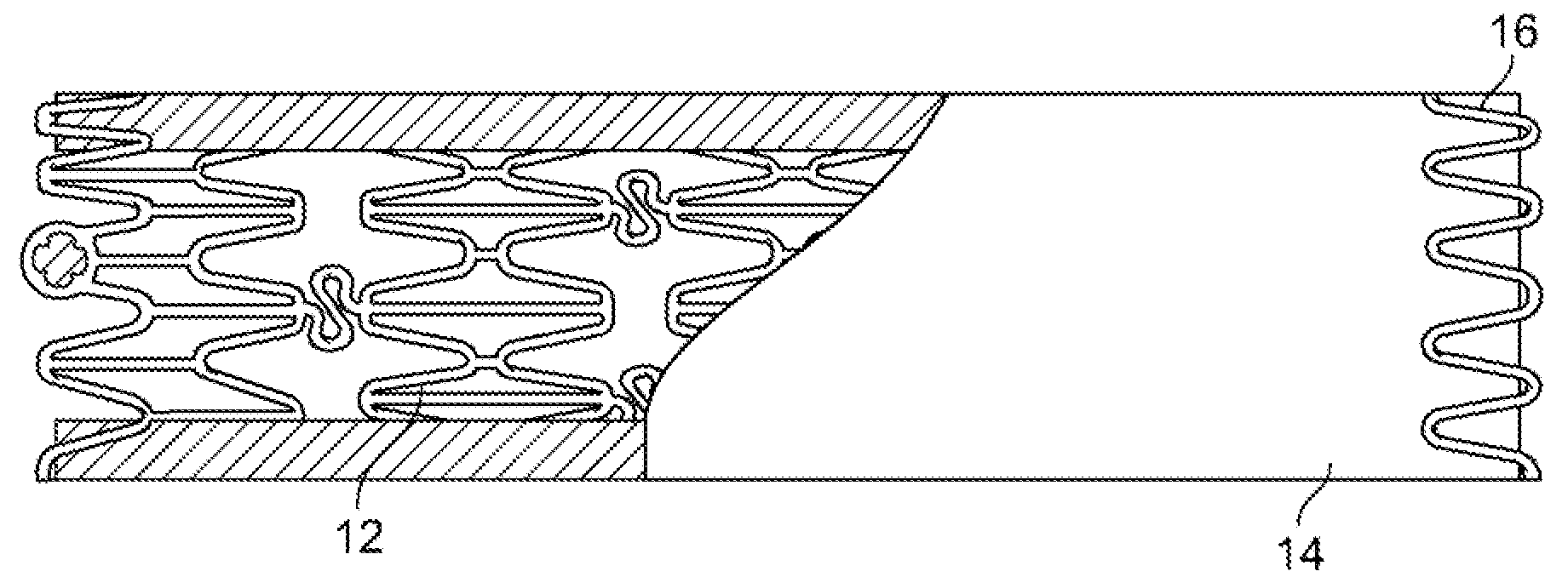 Anti-restenotic therapeutic device